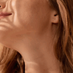 Cuidados de la Piel para Personas con Manchas Oscuras y Melasma cosmética natural Naturetica