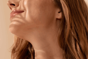 Cuidados de la Piel para Personas con Manchas Oscuras y Melasma cosmética natural Naturetica